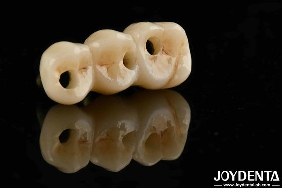 Excelente biocompatibilidad y alta resistencia de color realista de zirconio completo para soluciones de adquisición B2B