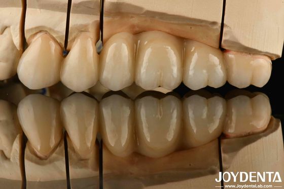 Zirconio blanco con alta resistencia al choque térmico