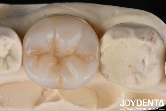 Multicapa de zircónia completa combinación definitiva de fuerza y estética para restauraciones dentales