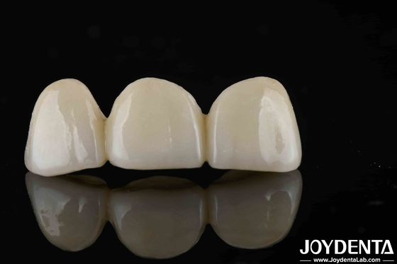 Estilo de aspecto natural con capas llenas de zirconia alta translucidez y estética