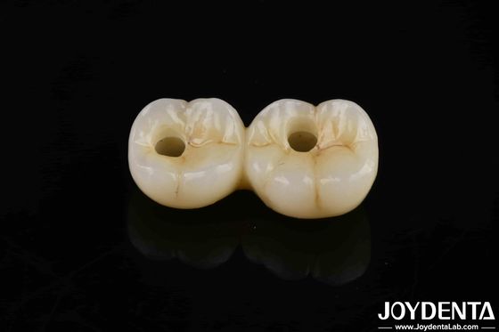 Resistencia a la flexión de 800 MPa Multicapa completa de zirconio de alta translucidez para restauraciones duraderas y de aspecto natural