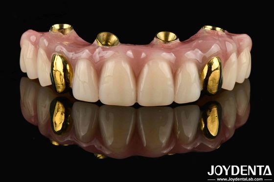 Finish de dientes acrílicos Ti-Bar para solución dental