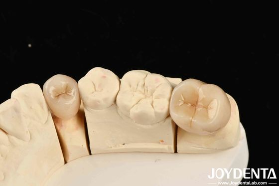 Excelente biocompatibilidad Zirconia completa con alta resistencia a la corrosión y resistencia a la flexión de 1000 MPa