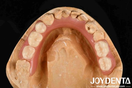 Personalización de la prótesis dental acrílica Finish buena elasticidad y propiedad ligera para mejorar el rendimiento protésico