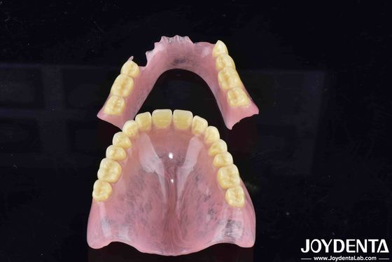 Tecnología avanzada de arreglo dental Dentadura acrílica con buena elasticidad y características diversas
