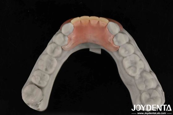Lleve su práctica dental al siguiente nivel Dentadura flexible con morfología natural y personalización personalizada