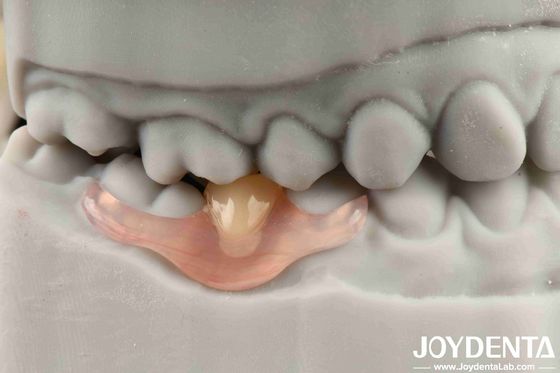 Flexible Denture Finish Personalización personalizada y tecnología avanzada de arreglo dental para necesidades personalizadas