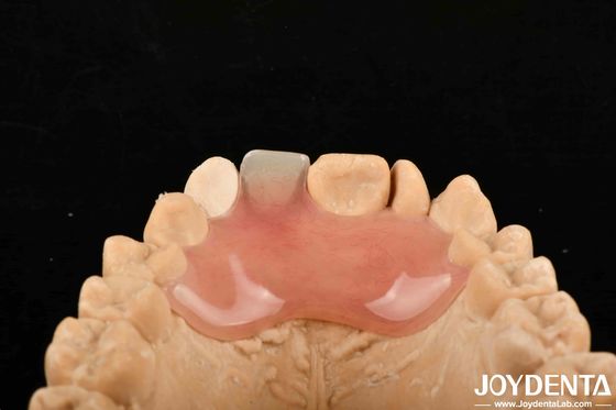 Alto sigilo buena elasticidad fin de dentadura flexible para diversos procesos de fabricación