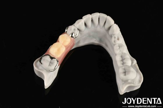 Estructura oral estable para los profesionales dentales en conectar firmemente la fila de dientes