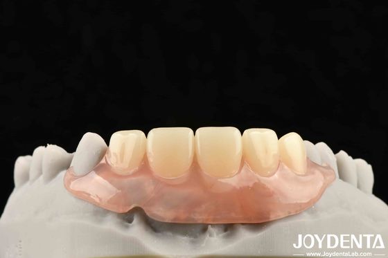 Establecer un marco tecnológico para el acabado de los dientes para una estructura oral estable en la tecnología dental Aplicar a la odontología