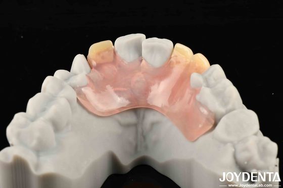 Estructura Oral Estable Marco de Efectos Establecer Dientes Finish Diseño de apariencia hermosa y armoniosa