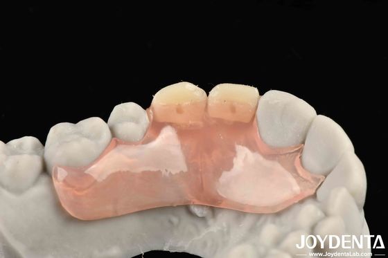 Estructura de diseño de apariencia hermosa y armoniosa Establecer dientes acabado Tecnología elaborada para una estructura oral estable