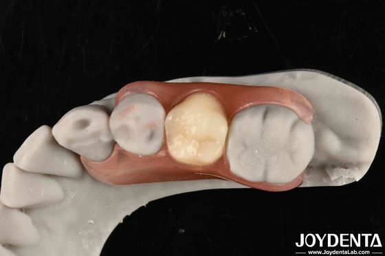 Revolucionar su marco de práctica dental Configurar dientes de acabado con tecnología elaborada de la odontología