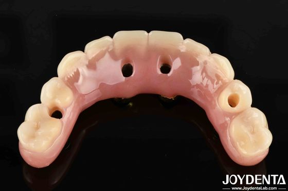 50 ml de Ti-Bar Acrílico Dental Finish 24 horas tiempo de curación Estados Unidos para profesionales dentales