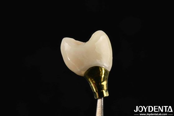Varios tamaños de implante corona y puente para implantes dentales fuertes Compatibilidad