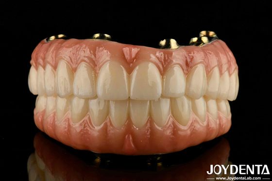 Los dientes y las encías naturales Puente híbrido de zirconia de Ti-Bar compatible con alta biocompatibilidad