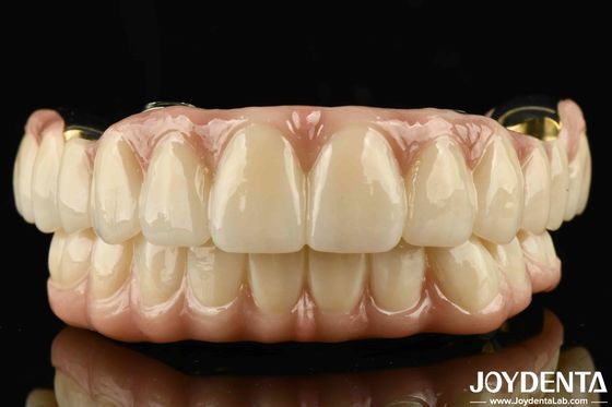 Puente híbrido de zirconia de Ti-Bar de excelente resistencia para la compatibilidad de dientes y encías naturales