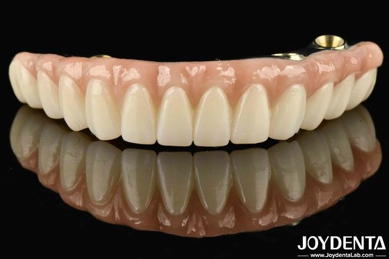 Puente híbrido de zirconia de Ti-Bar compatible con dientes y encías naturales Autobiografía Restaurar la función de masticación
