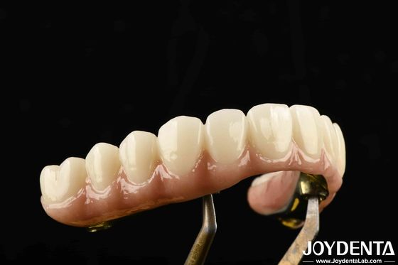 Puente híbrido de zirconia de barra de Ti fabricado con materiales de titanio y zirconia para uso pesado