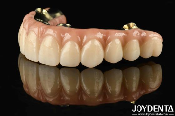 Puente híbrido de zirconia de barra de Ti hecho a medida Resistente a la corrosión y al desgaste Restaurar la función de masticación con precisión