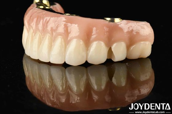 Transforme su restauración dental con puente híbrido de zirconia de Ti-Bar duradero y duradero