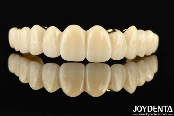 Puente híbrido de zirconia hecho a medida La combinación perfecta de comodidad y funcionalidad