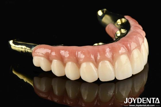 Di adiós a los dientes perdidos con zirconia de aspecto natural y duradero