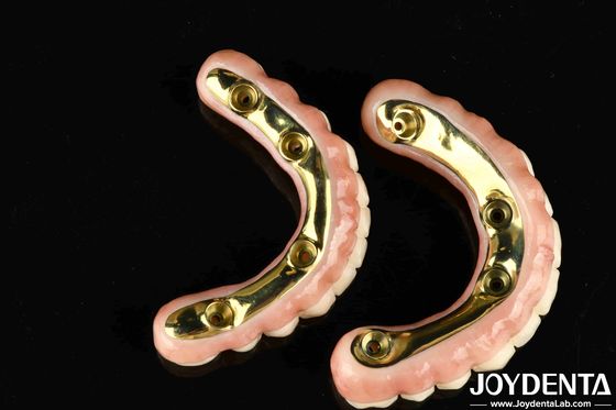 Puente híbrido de zirconia con alta durabilidad y biocompatibilidad