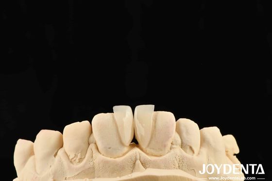Alta durabilidad Micro Veneer 0.2 mm de espesor y rendimiento confiable