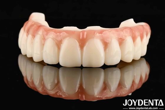 Superficie resistente a los arañazos para restauraciones duraderas Dentarias M75 Restauraciones duraderas