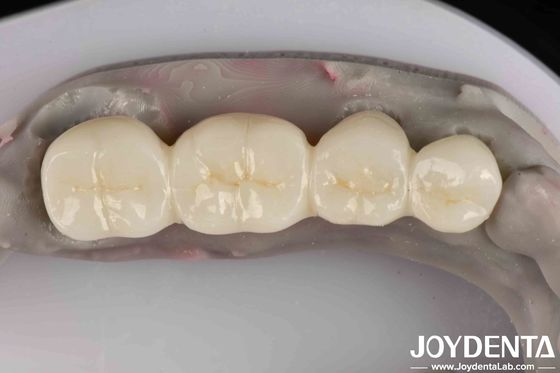 Excelente producto blanco de zirconio completo con alta resistencia a la corrosión