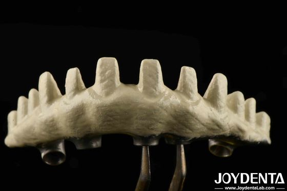 Tipo de conexión hexagonal interna Abutments de implantes personalizados empapados y grabados con ácido para un ajuste superior