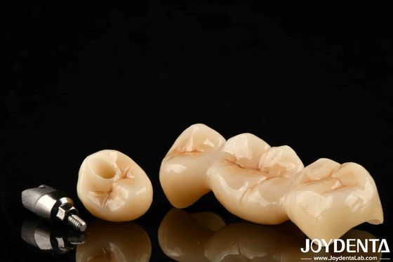 Multicapa de zircónia completa alta resistencia a las grietas y durabilidad para restauraciones dentales duraderas