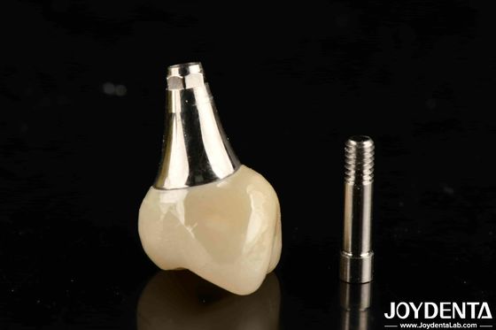Implantes dentales biocompatibles coroneta y puente estéticamente agradables para la seguridad oral