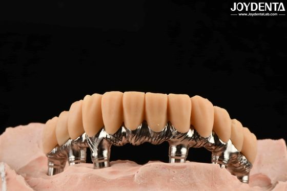 Dientes temporales de resina amarilla Tratamiento de superficie lisa Precisa y estable