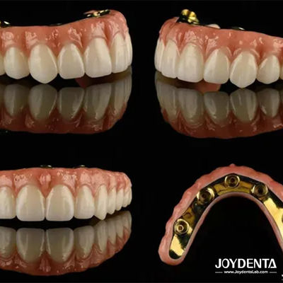 Puentes de implantes híbridos de Ti Bar Zirconia de alta translucidez para prótesis dental
