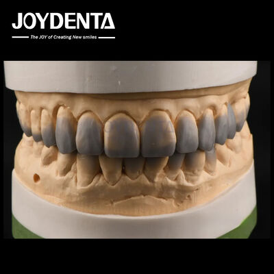 Uso temporal Cera de diagnóstico Dentes de textura lisa Cera a medida