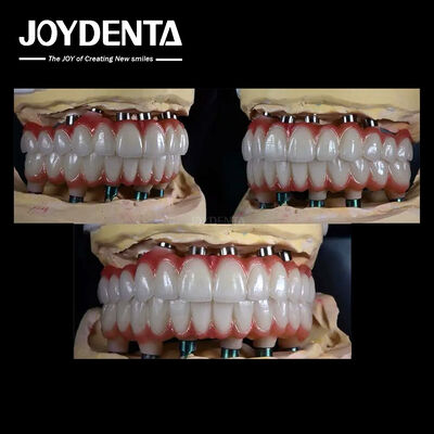 Implante dental múltiple de titanio de 10 mm Superficie áspera para la restauración dental