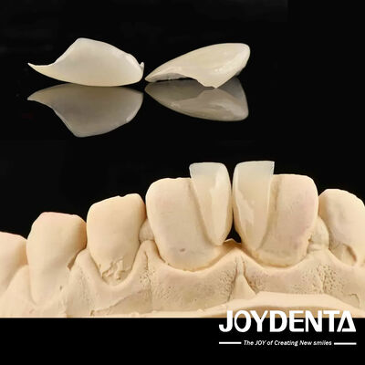 Alta durabilidad Micro Veneer 0.2 mm de espesor y rendimiento confiable