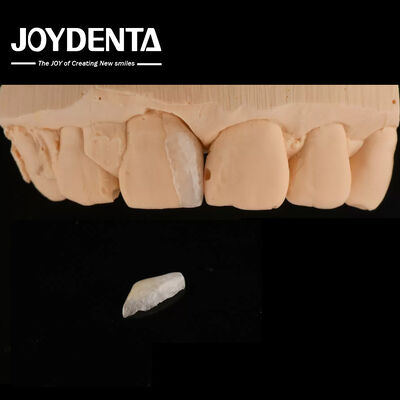 Carcasa delgada micro carcasa tratamiento dental cosmético carcasa delgada delgada de los dientes