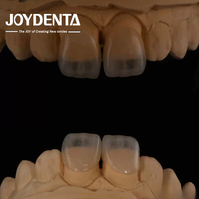 Fabricación dental de microdentes ecológicos de 0,2 mm de espesor y textura lisa