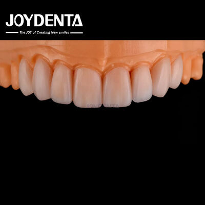 Veneer de vidrio cerámico personalizable de aspecto natural y alta resistencia química