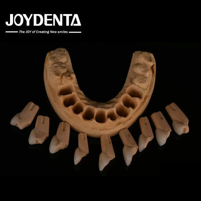 Venecedura dental feldspática de ajuste preciso muy natural con textura de superficie brillante