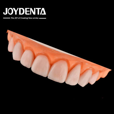 Fabricación a medida IPS Porcelana Emax Carillas Restauraciones dentales Resistente a las astillas
