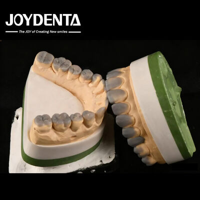 Cera dental temporal de diagnóstico de alta precisión hasta el espesor personalizado de 1-2 mm